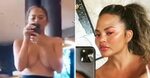 Chrissy Teigen updates fans on breast implant removal surger